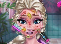 Frozen Elsa no Dermatologista