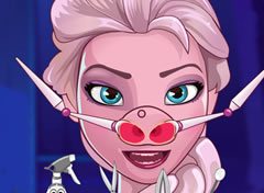 Frozen Elsa no Médico de Nariz