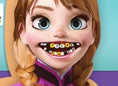 Frozen Princesa Anna no Dentista 2
