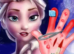 Frozen Elsa com a Mão Machucada